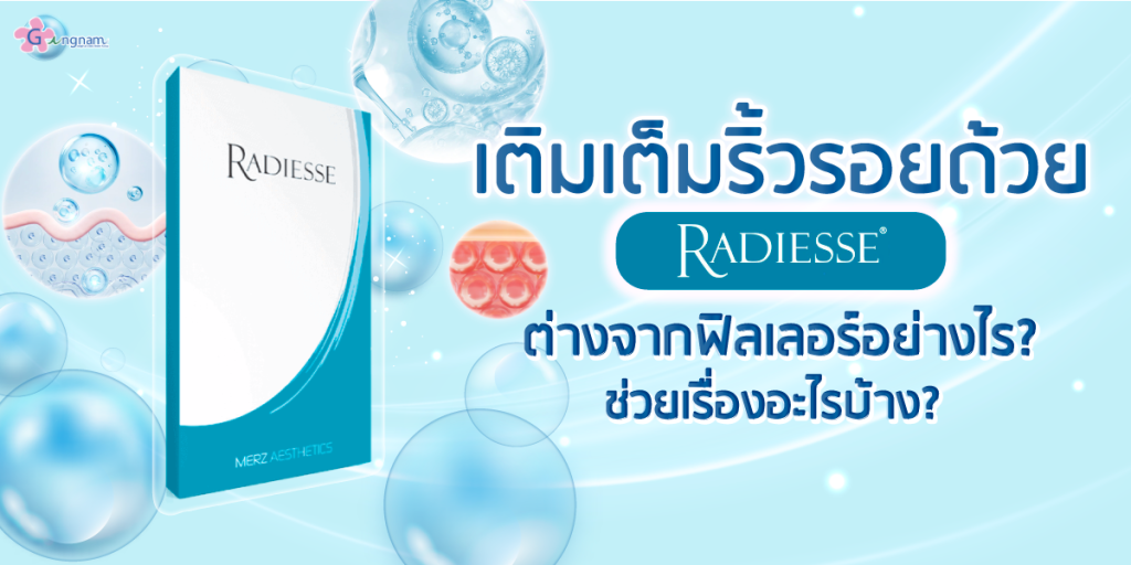 เติมเต็มริ้วรอยด้วย Radiesse คืออะไร_ ต่างจากฟิลเลอร์อย่างไร_ ช่วยเรื่องอะไรบ้าง