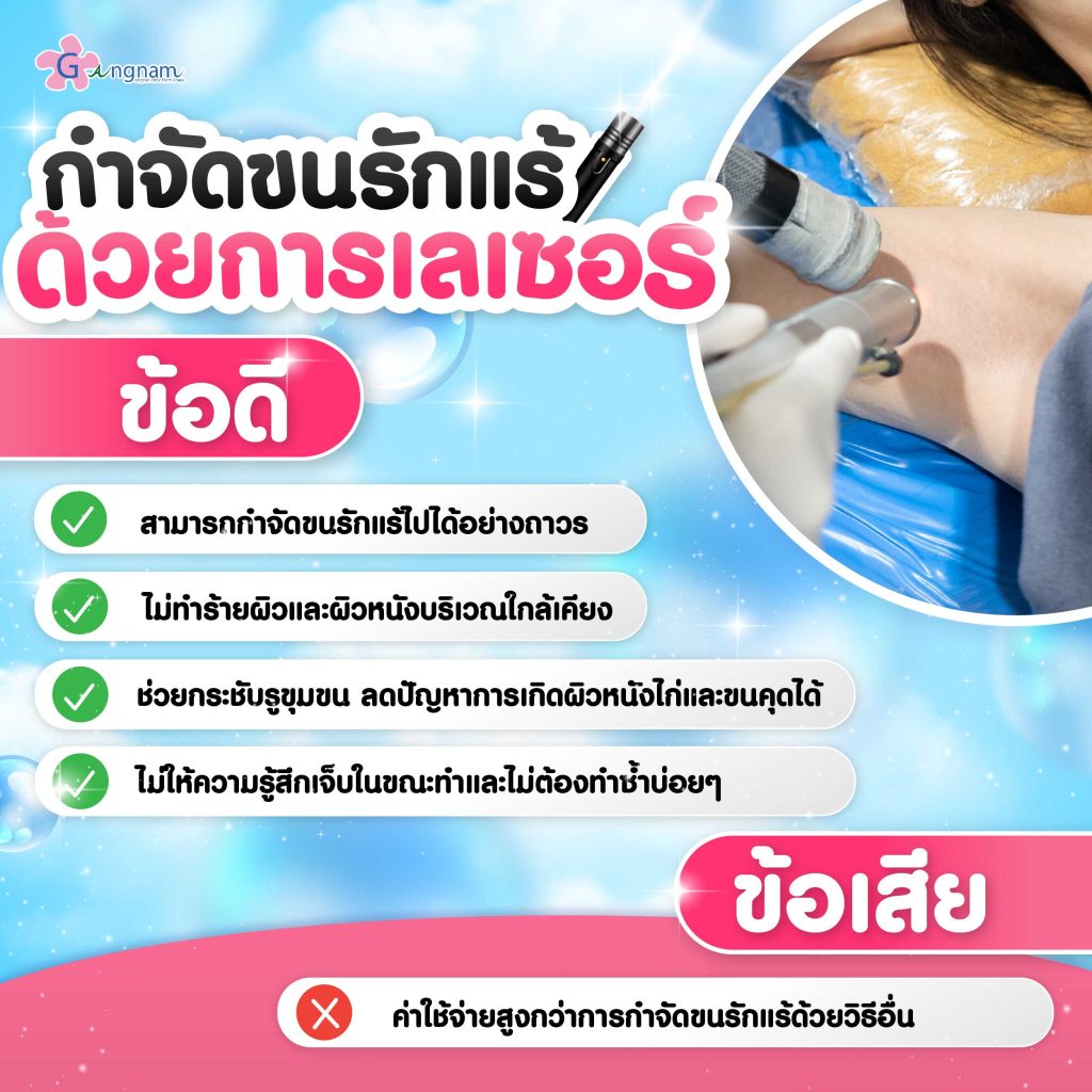 การทำเลเซอร์ขนรักแร้