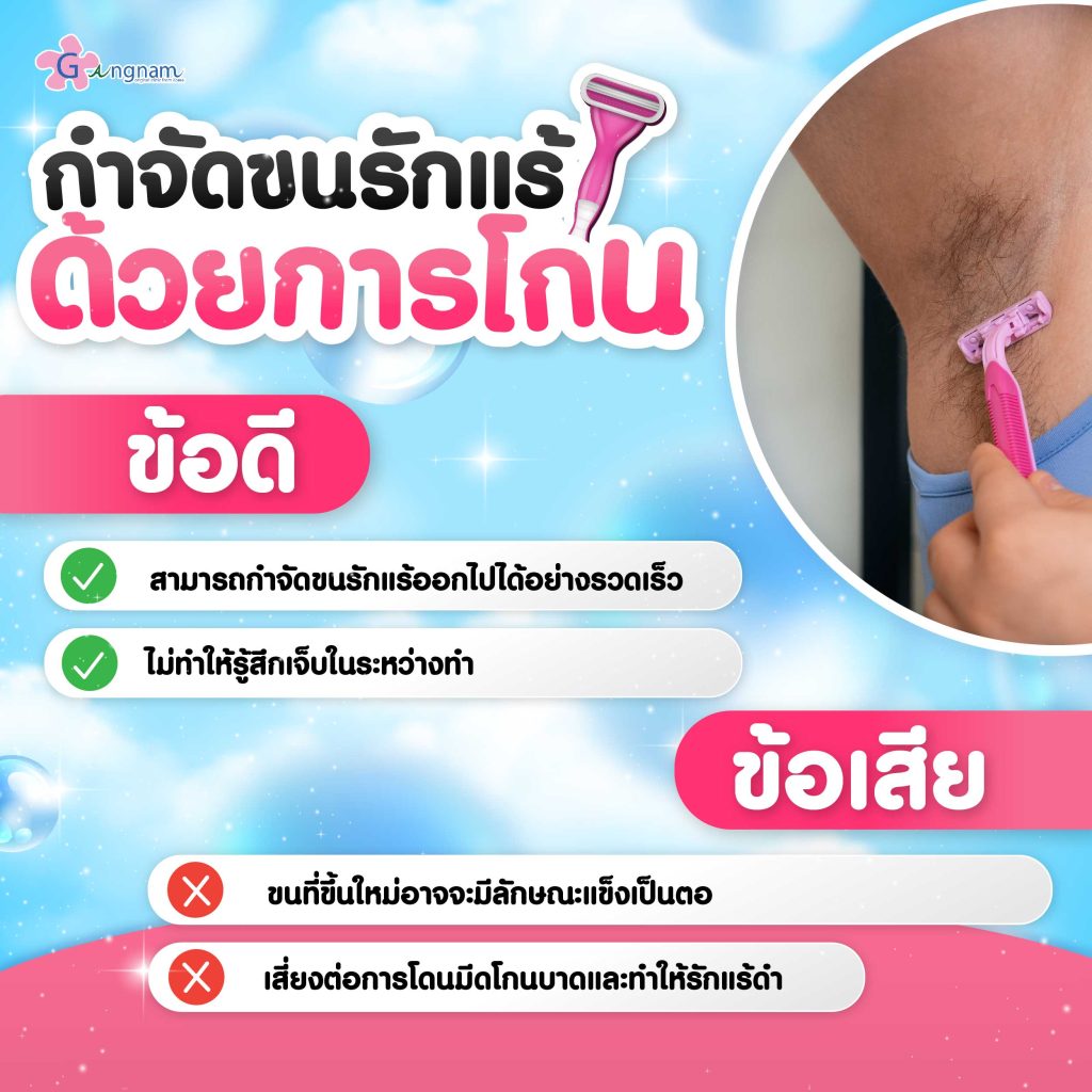 การโกนขนรักแร้