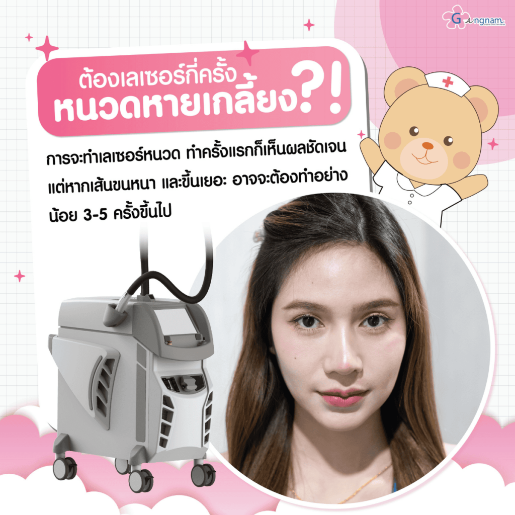 เลเซอร์หนวดต้องทำกี่ครั้งจึงเห็นผล?