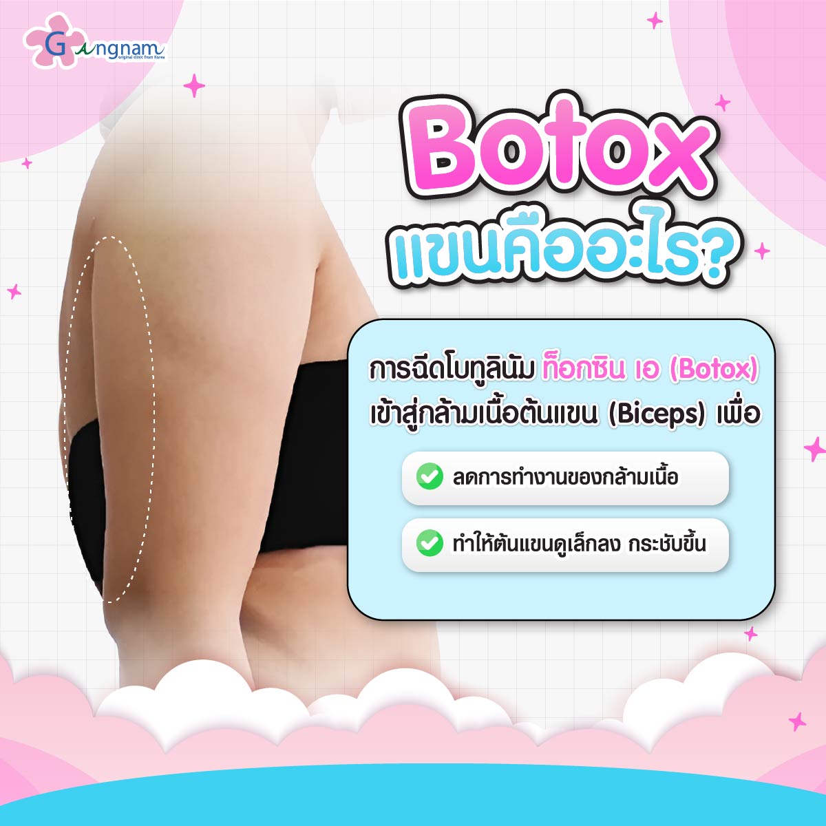 Botox แขนคืออะไร