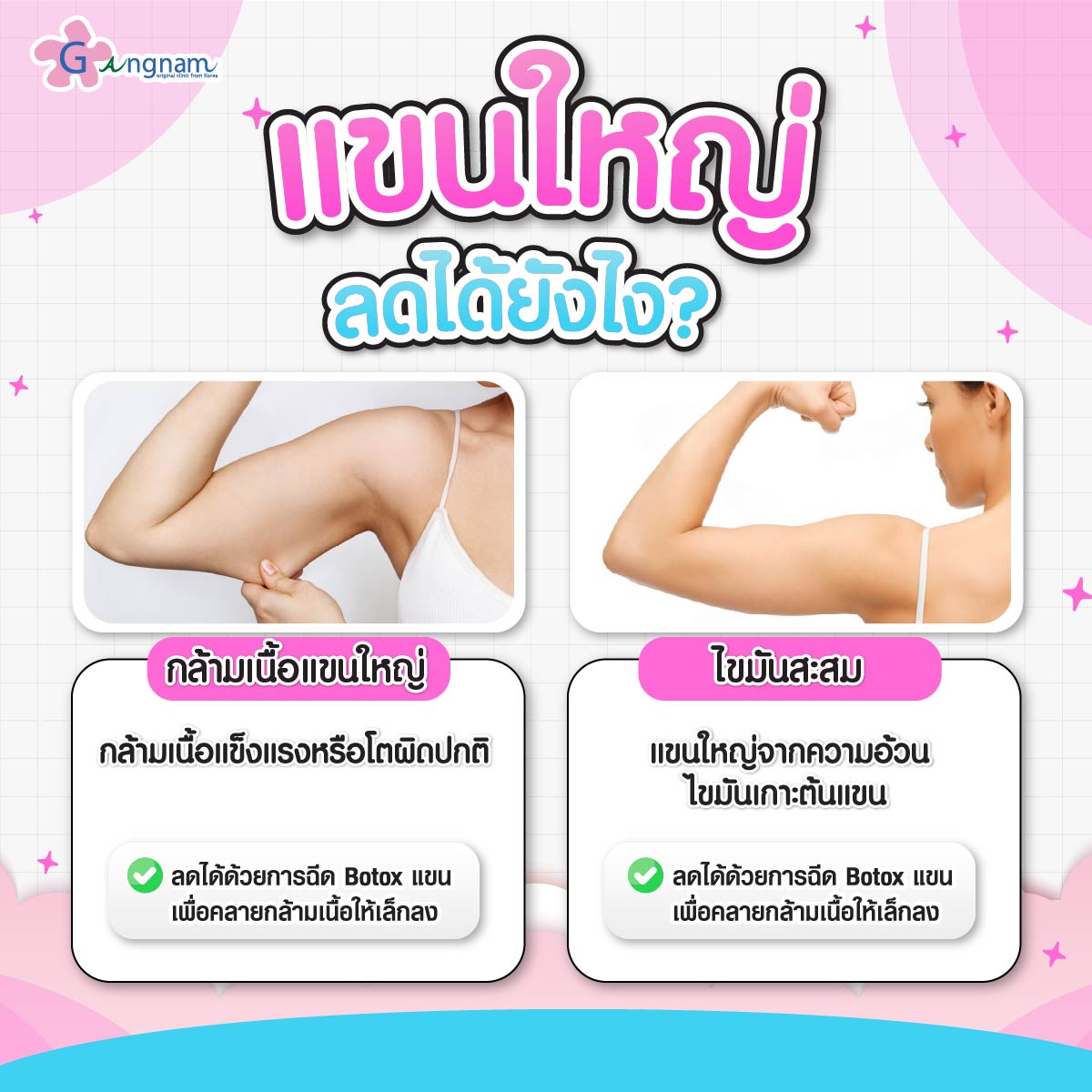 สาเหตุของการเกิดแขนใหญ่มาจากอะไร? และลดได้ด้วยวิธีใดบ้าง?