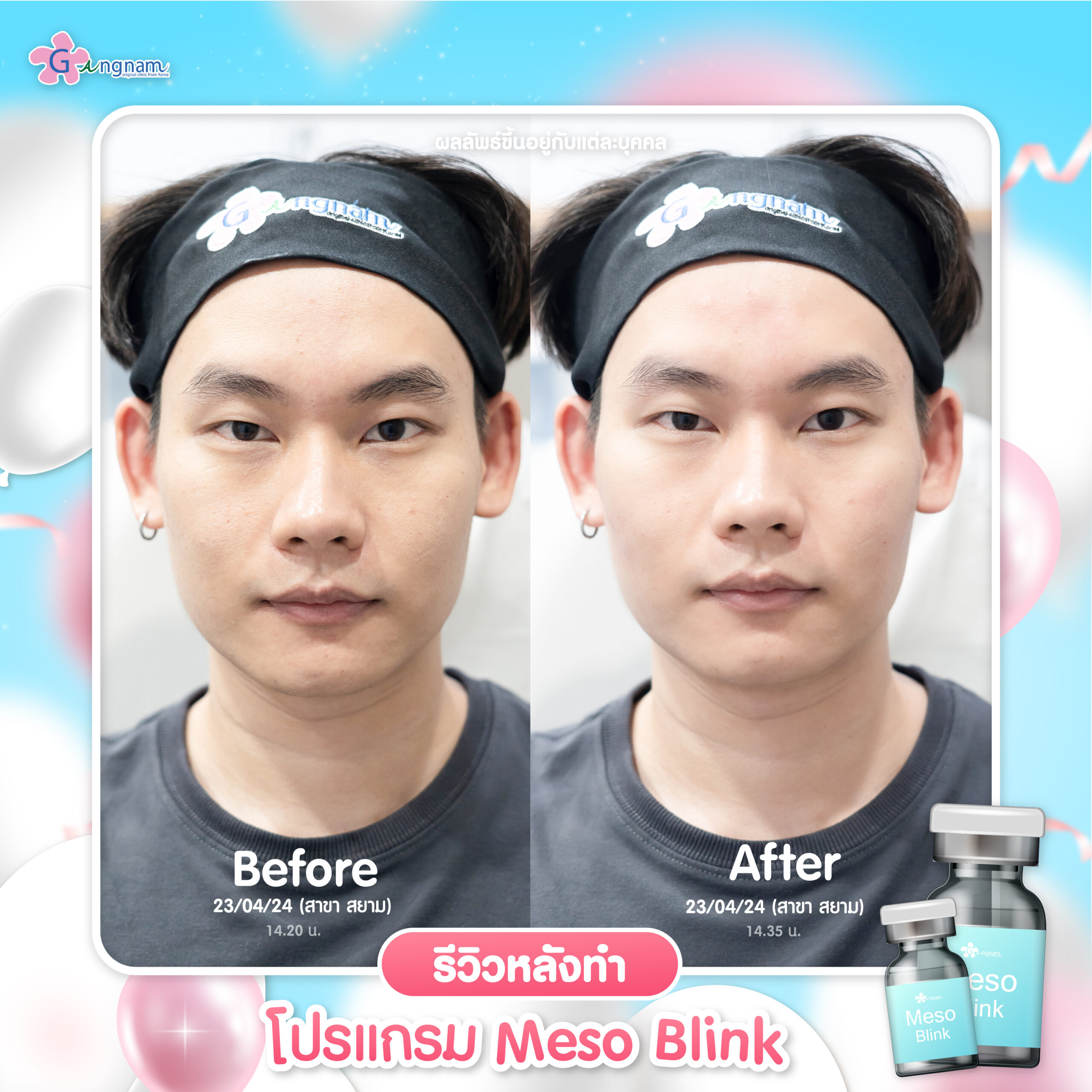 Meso Blink Review 3