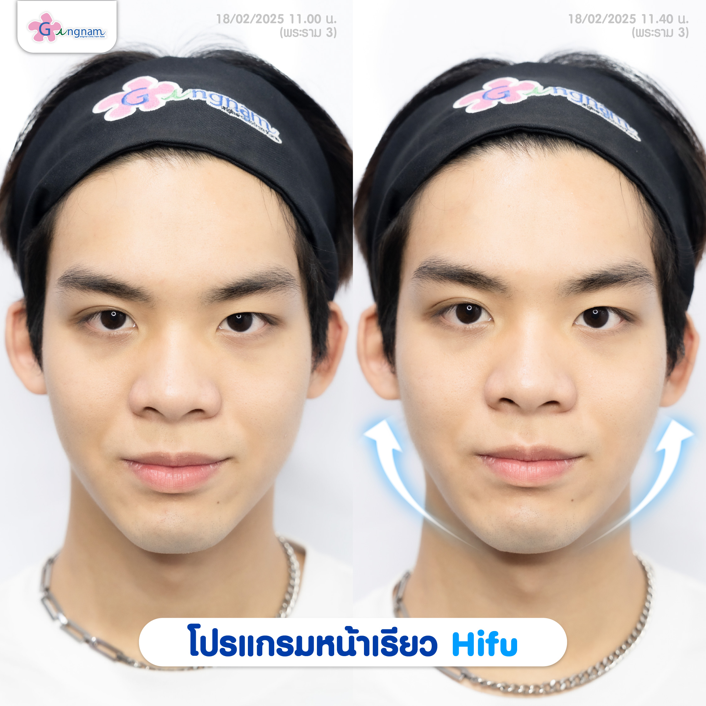 Ads Review 2