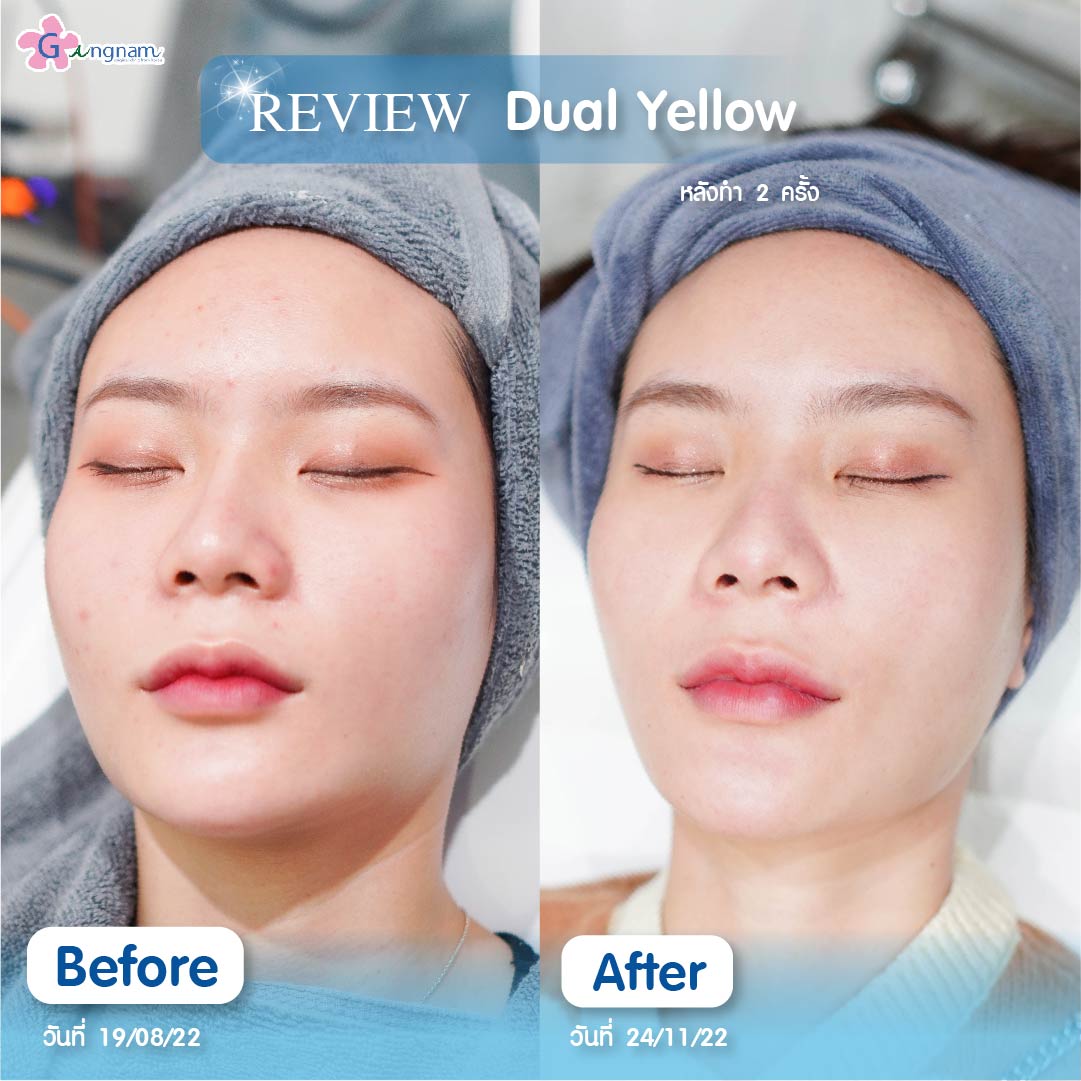 Dual Yellow Review 2