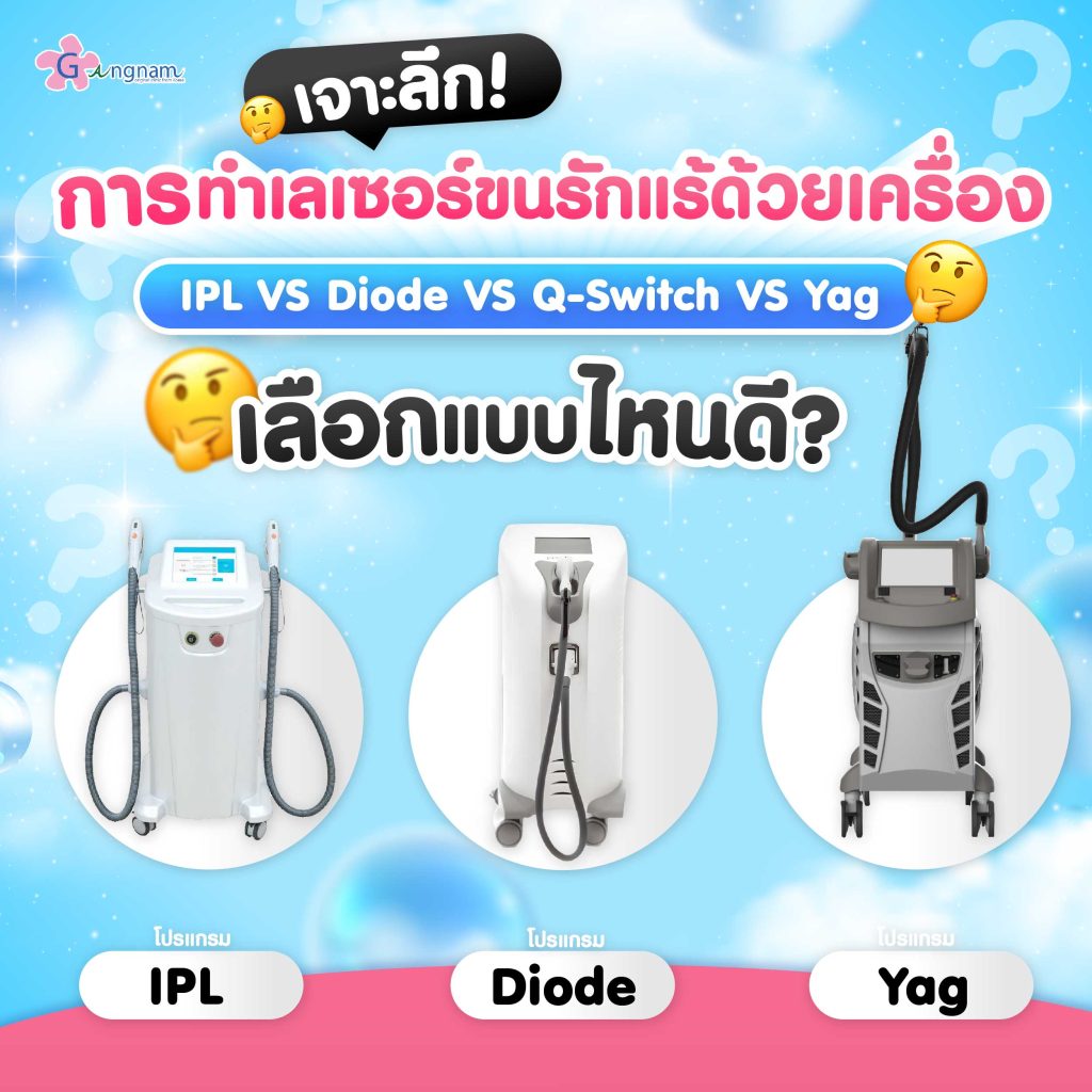 เจาะลึกการทำเลเซอร์ขนรักแร้ด้วยเครื่อง IPL VS Diode  VS Yag เลือกแบบไหนดี?  