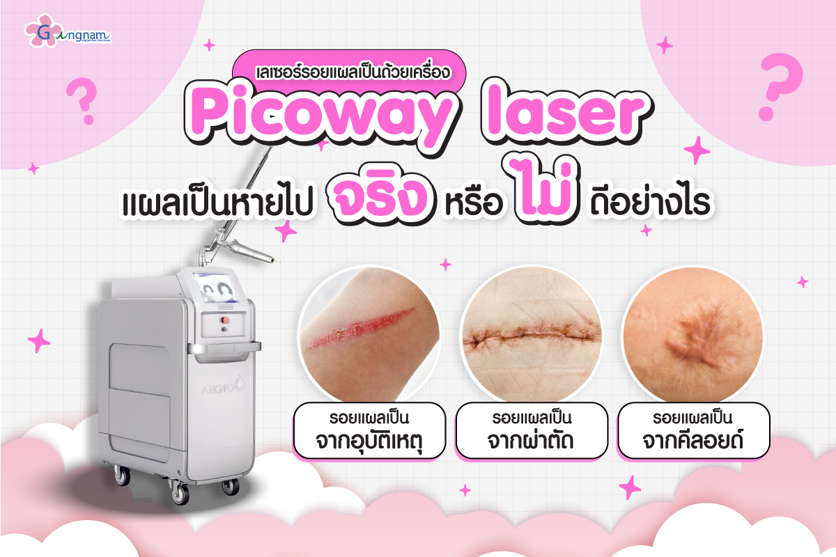 เลเซอร์รอยแผลเป็นด้วยเครื่อง Picoway laser แผลเป็นหายไปจริงหรือไม่ ดีอย่างไร