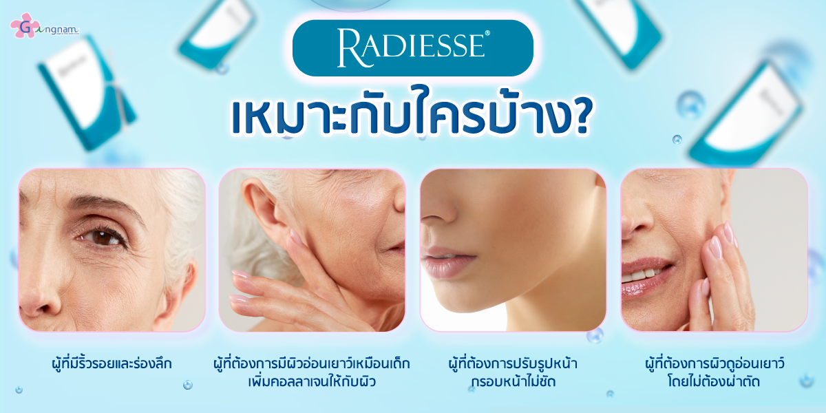 Radiesse เหมาะกับใครบ้าง?