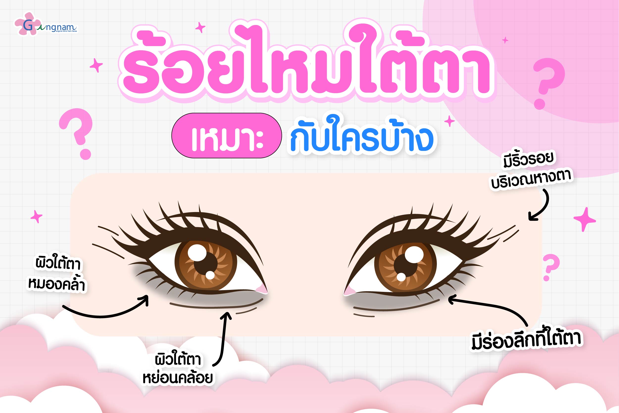 ร้อยไหมใต้ตา ด้วยไหมฟิลเลอร์เหมาะกับใคร​