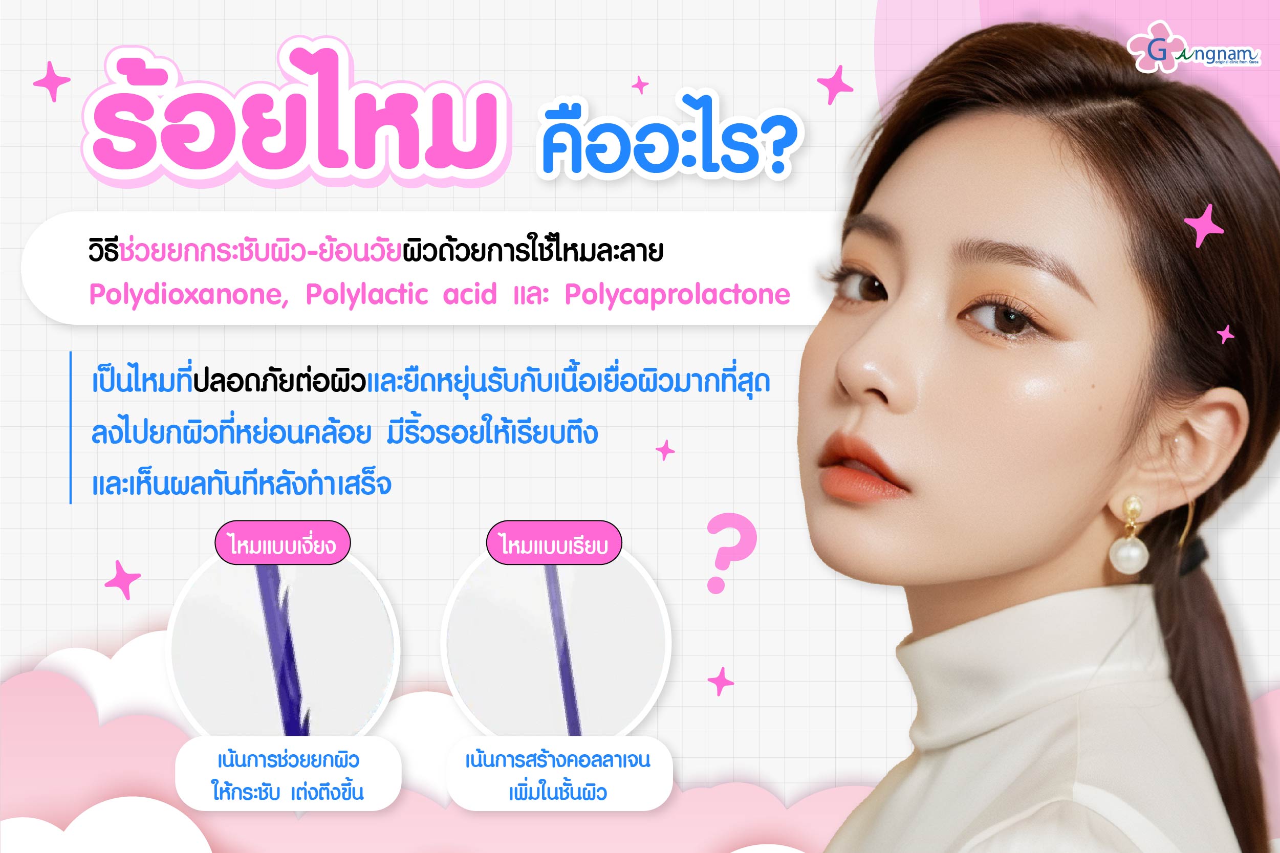 ร้อยไหม คืออะไร?​