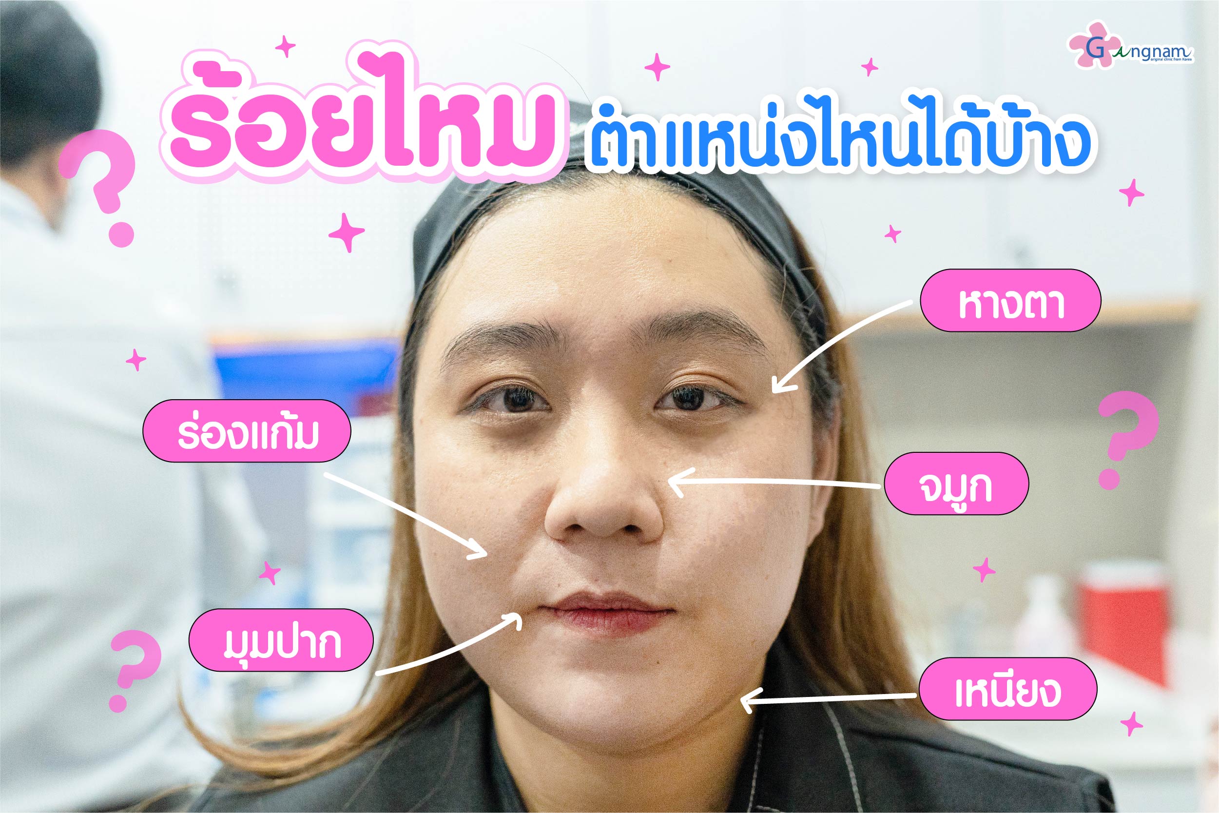 ร้อยไหม ตำแหน่งไหนได้บ้าง​