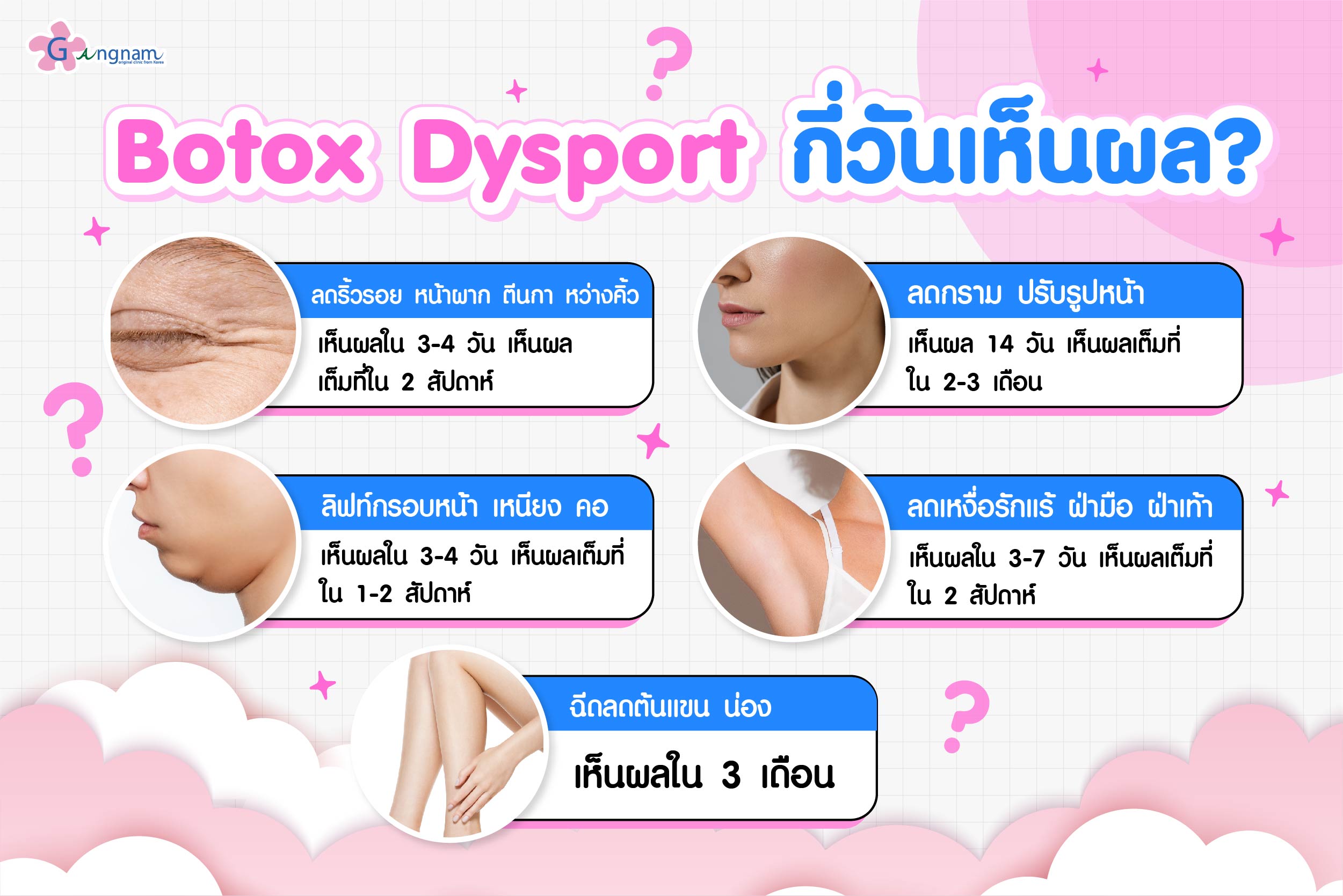 ฉีดโบท็อกซ์อังกฤษ Dysport กี่วันเห็นผล?