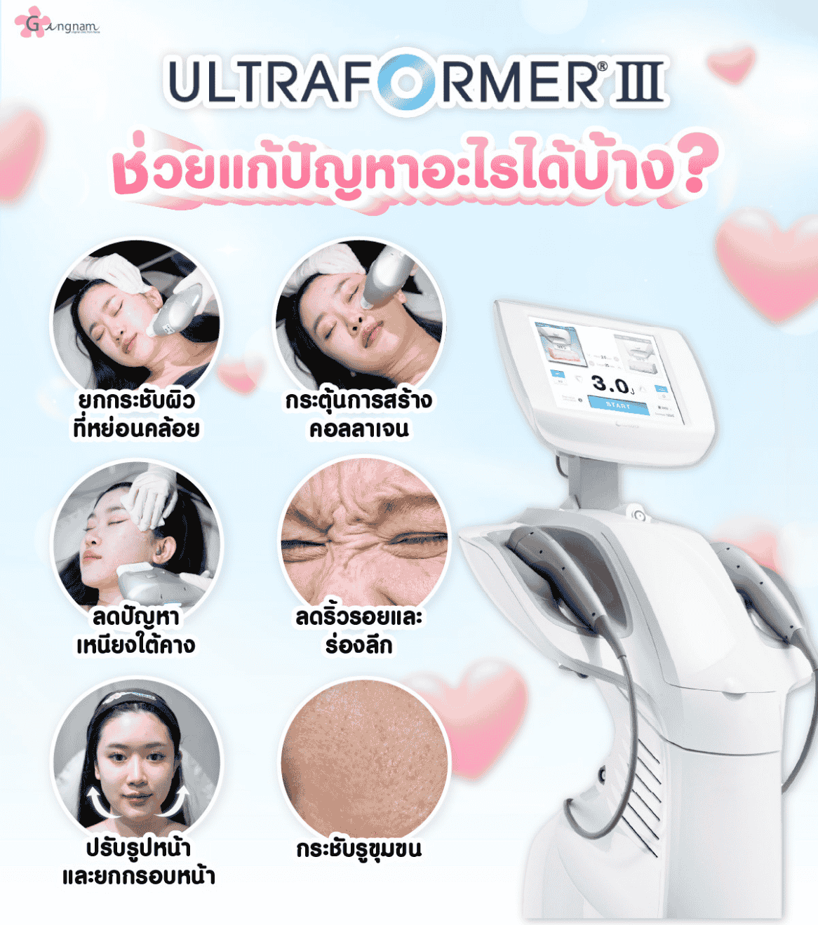 UltraformerIIIช่วยแก้ปัญหาอะไรได้บ้าง