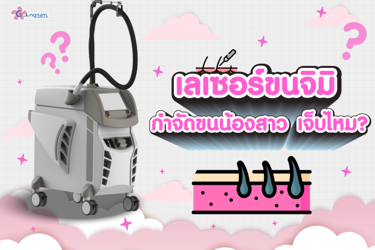 เลเซอร์ขนจิมิ Nd:YAG รีวิวขนคุด