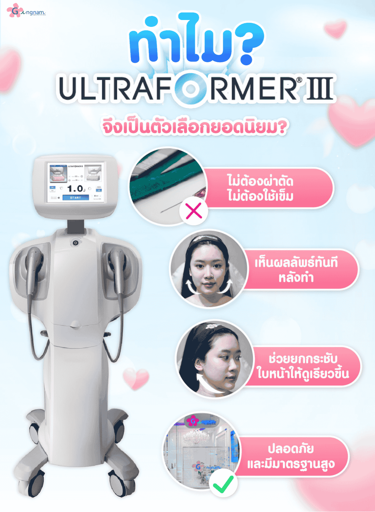 ทำไมUltraformerIIIจึงเป็นตัวเลือกยอดนิยม