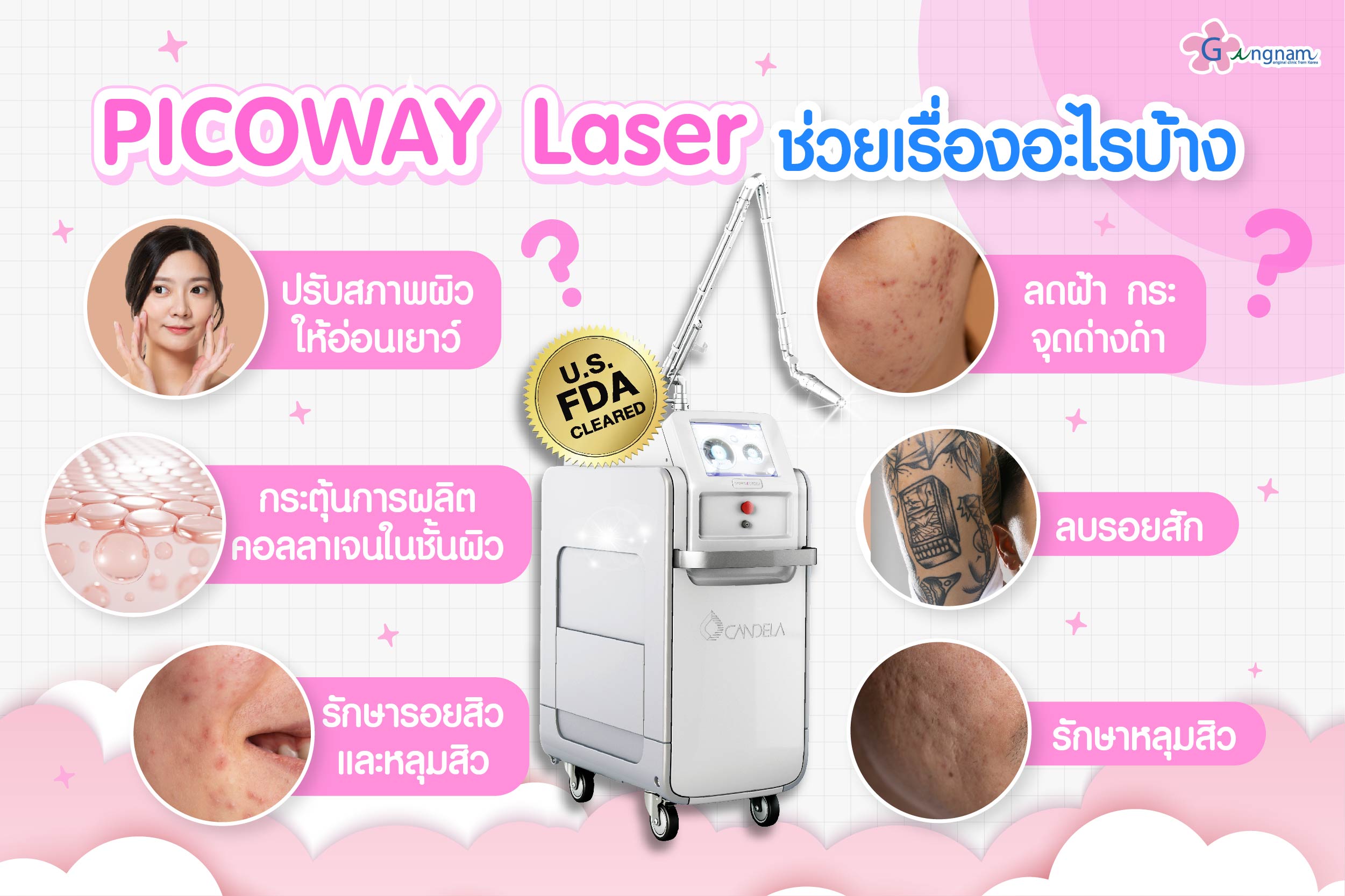 เลเซอร์ Picoway คืออะไร?