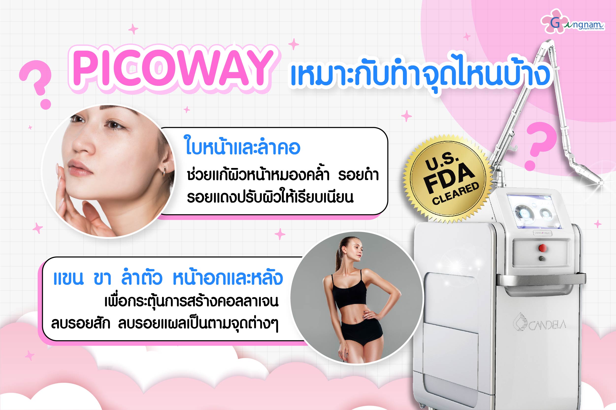 การใช้เลเซอร์ Picoway Laser  เหมาะกับทำจุดไหนบ้าง? 