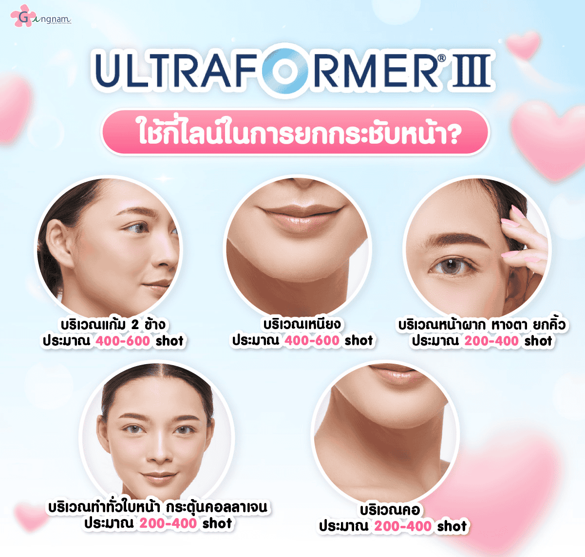 Ultraformer III ใช้กี่ไลน์ในการยกกระชับหน้า?​