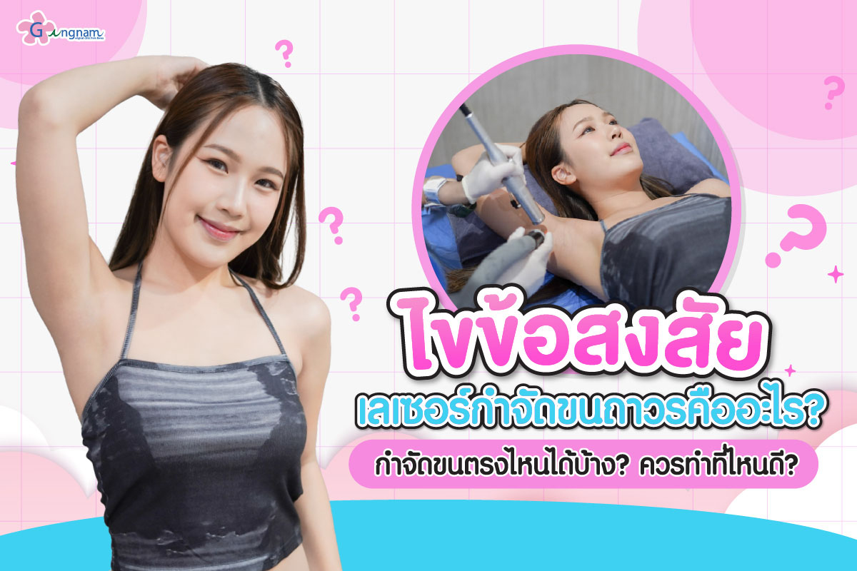 ไขข้อสงสัยเลเซอร์กำจัดขน​ถาวร​คืออะไร