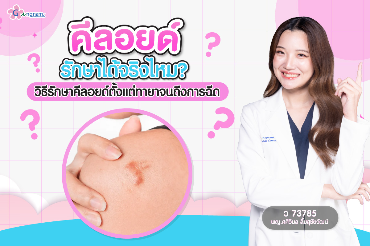 แผลเป็นคีลอยด์รักษาได้จริงไหม? รวบรวมทุกวิธีการรักษาคีลอยด์ ตั้งแต่การทายาไปจนถึงการฉีด