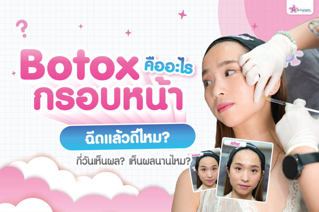 Botox ลิฟกรอบหน้าคืออะไร? ฉีดแล้วดีไหม? กี่วันเห็นผล? เห็นผลนานไหม?