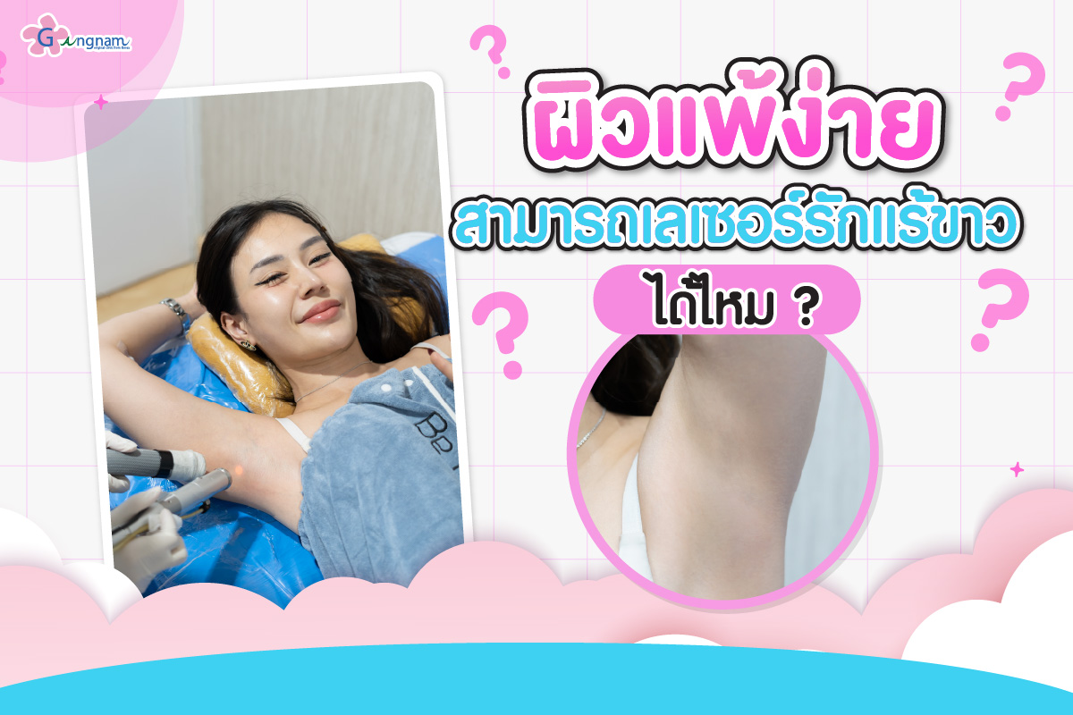 ผิวแพ้ง่ายสามารถเลเซอร์รักแร้ขาว ได้ไหม