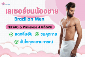 male-brazilian-ndyag-primelase