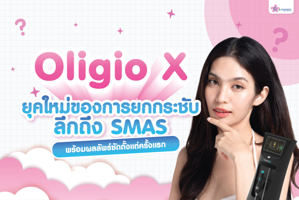 Oligio X ยุคใหม่ของการยกกระชับที่ลึกถึง SMAS พร้อมผลลัพธ์ชัดตั้งแต่ครั้งแรก