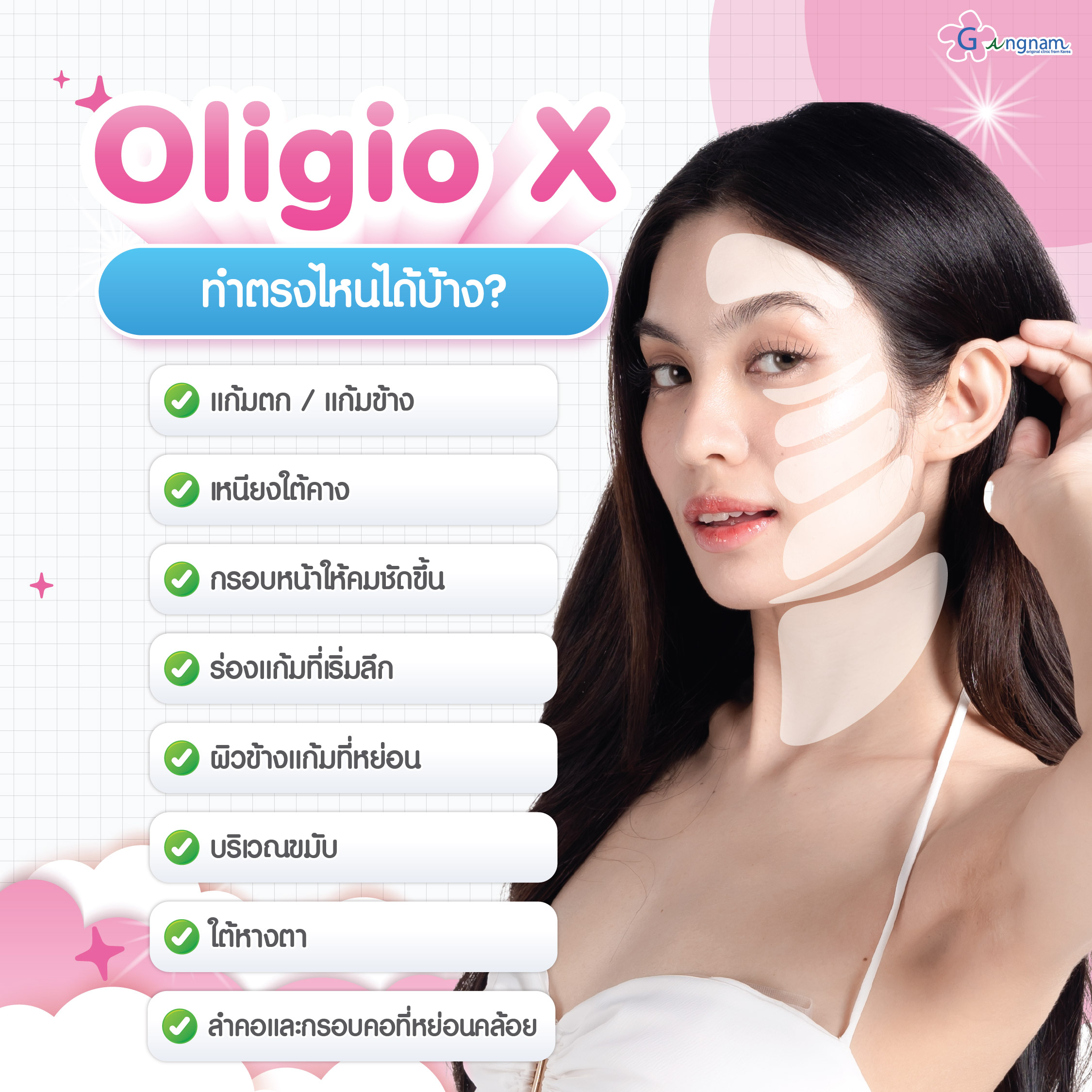 Oligio X ทำตรงไหนได้บ้าง?