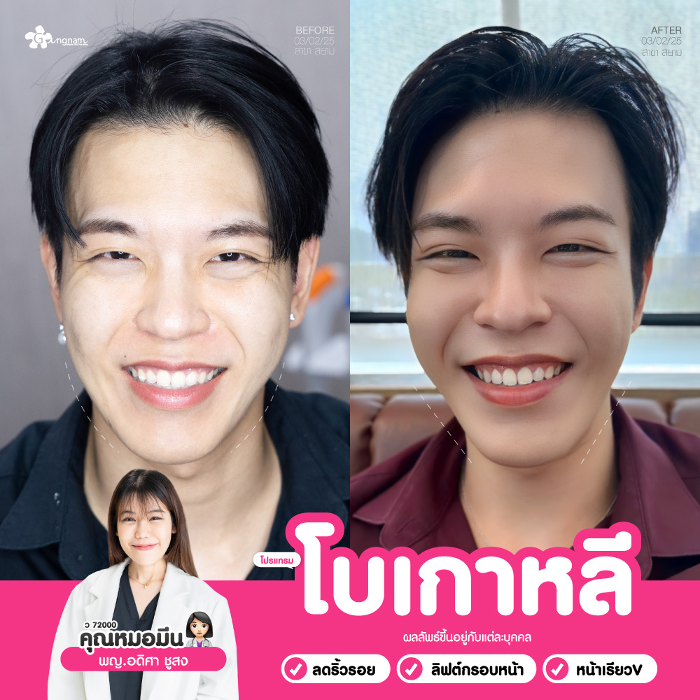 โบเกาหลี กังนัมคลินิก