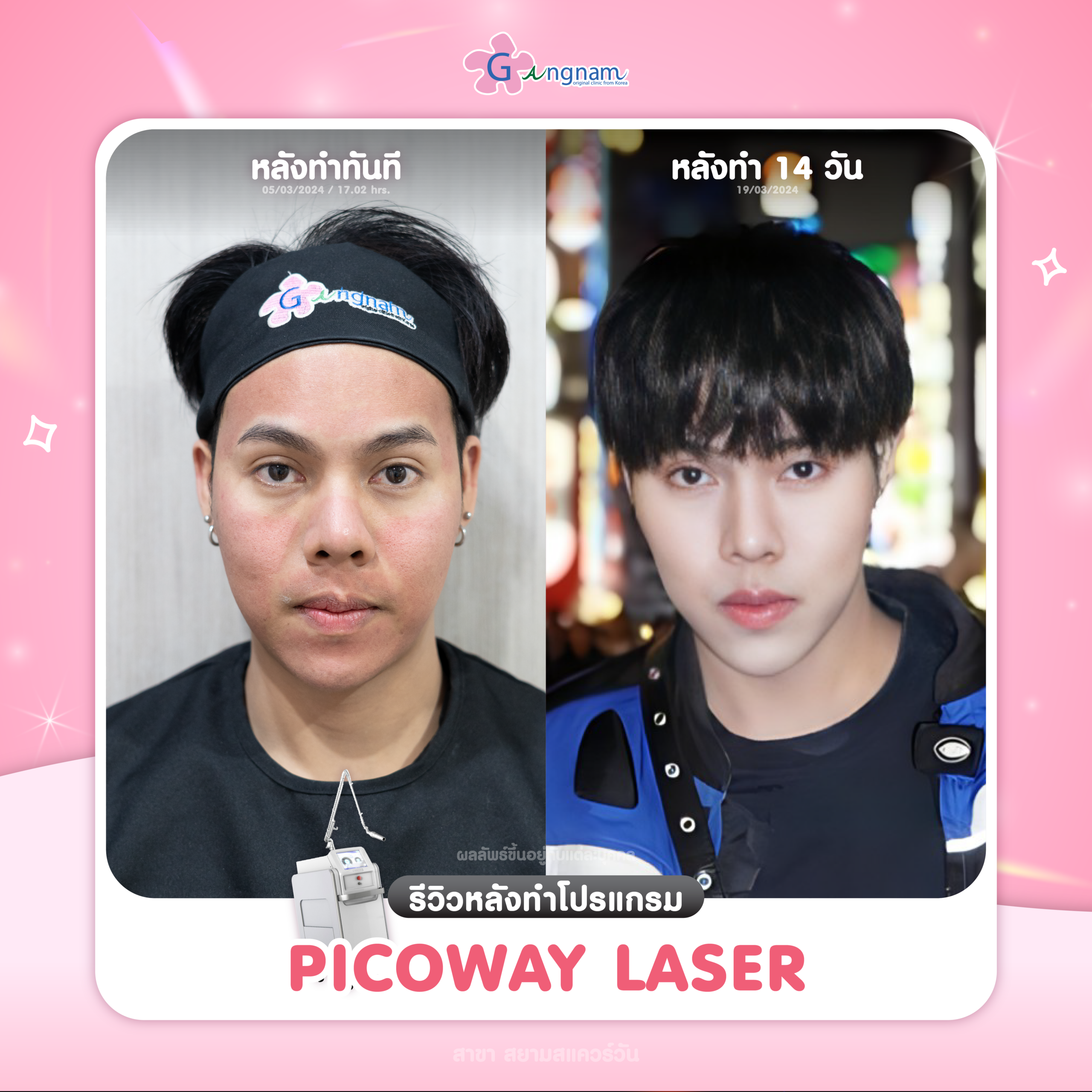 กังนัมคลินิก Picoway