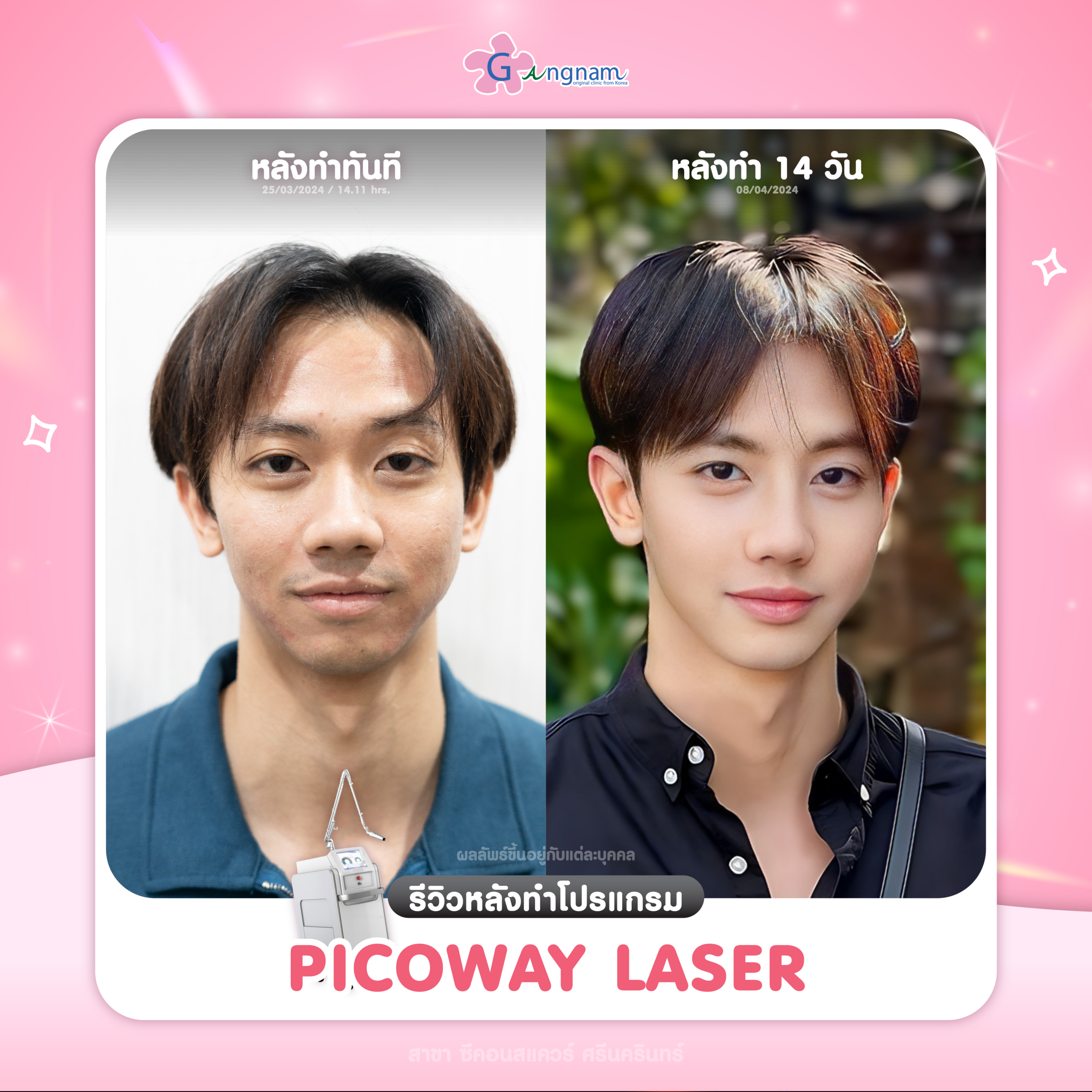 ผลลัพธ์ Picoway