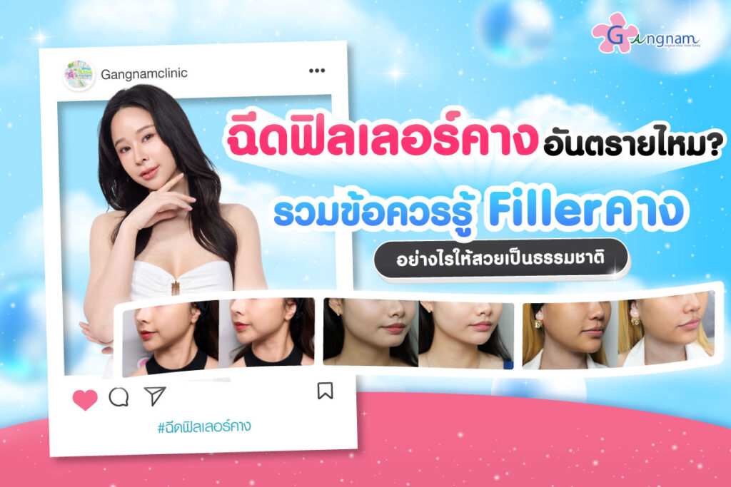 ฉีดฟิลเลอร์คาง อันตรายไหม? รวมข้อควรรู้ Filler คางอย่างไรให้สวยเป็นธรรมชาติ