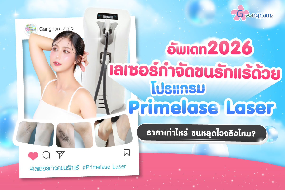 อัพเดท 2026 เลเซอร์กำจัดขนรักแร้ด้วยโปรแกรม Primelase Laser ราคาเท่าไหร่ ขนหลุดไว จริงไหม