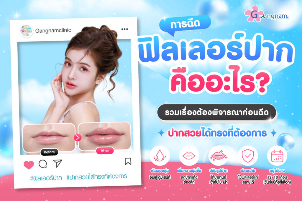 การฉีดฟิลเลอร์ปาก