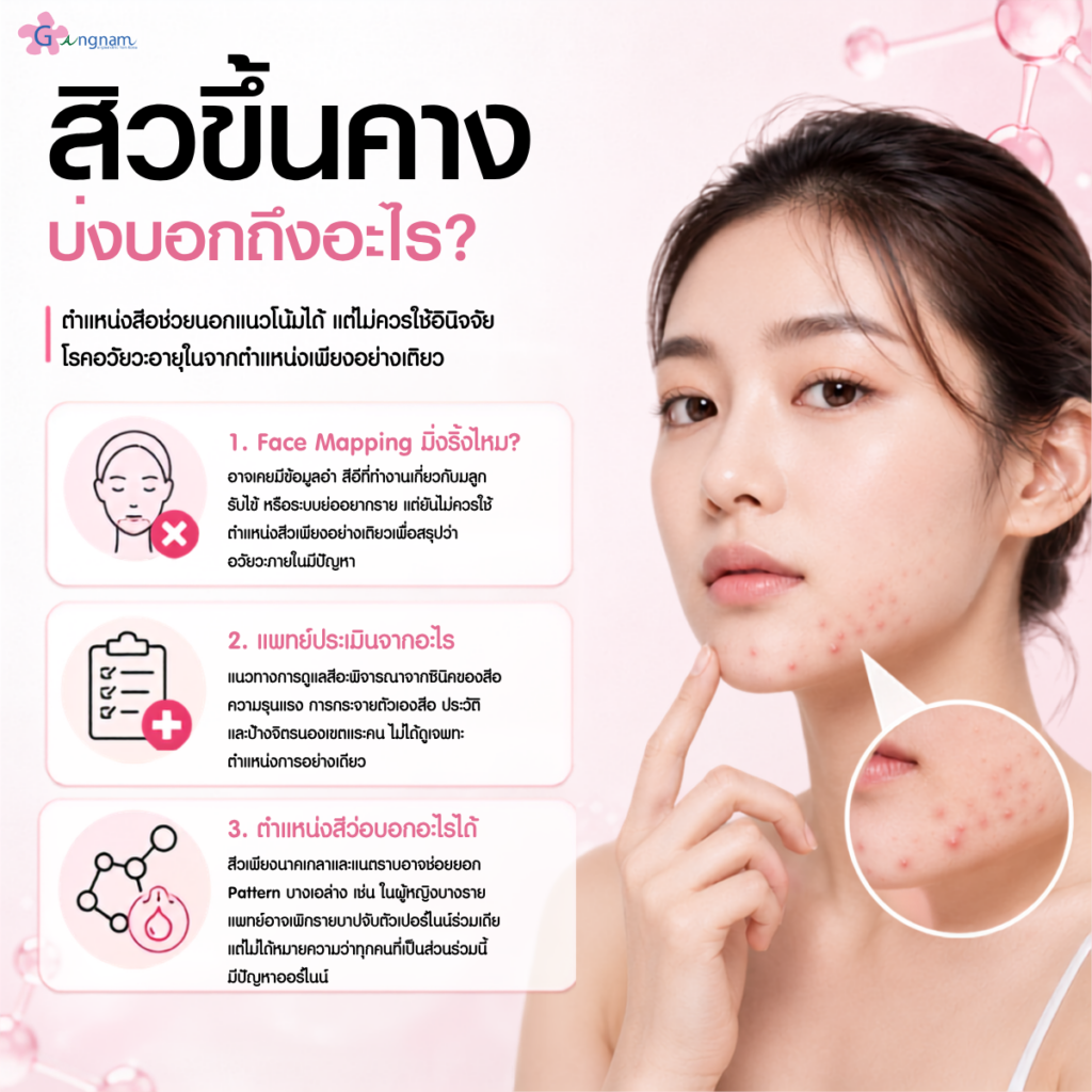 สิวขึ้นคางบ่งบอกถึงอะไร?