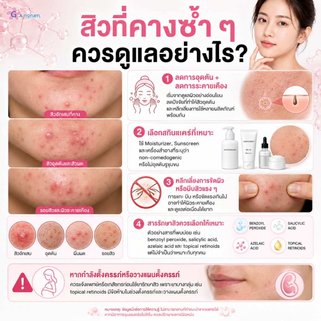 เป็นสิวที่คางซ้ำ ๆ ควรดูแลอย่างไร?