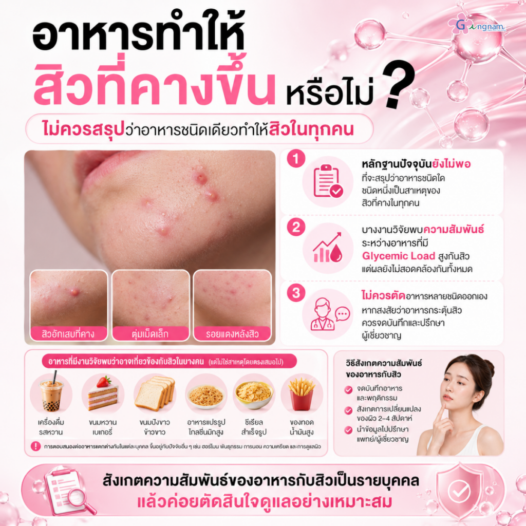 อาหารทำให้สิวที่คางขึ้นหรือไม่?
