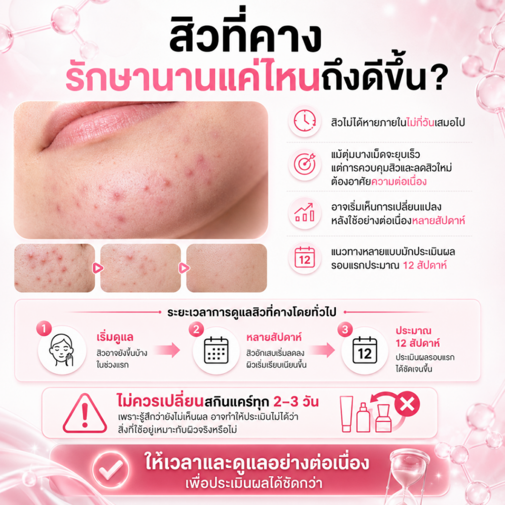 สิวที่คางรักษานานแค่ไหนถึงดีขึ้น?