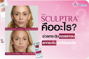 Sculptra คืออะไร? ช่วยกระตุ้นคอลลาเจนและยกกระชับหน้าได้อย่างไร