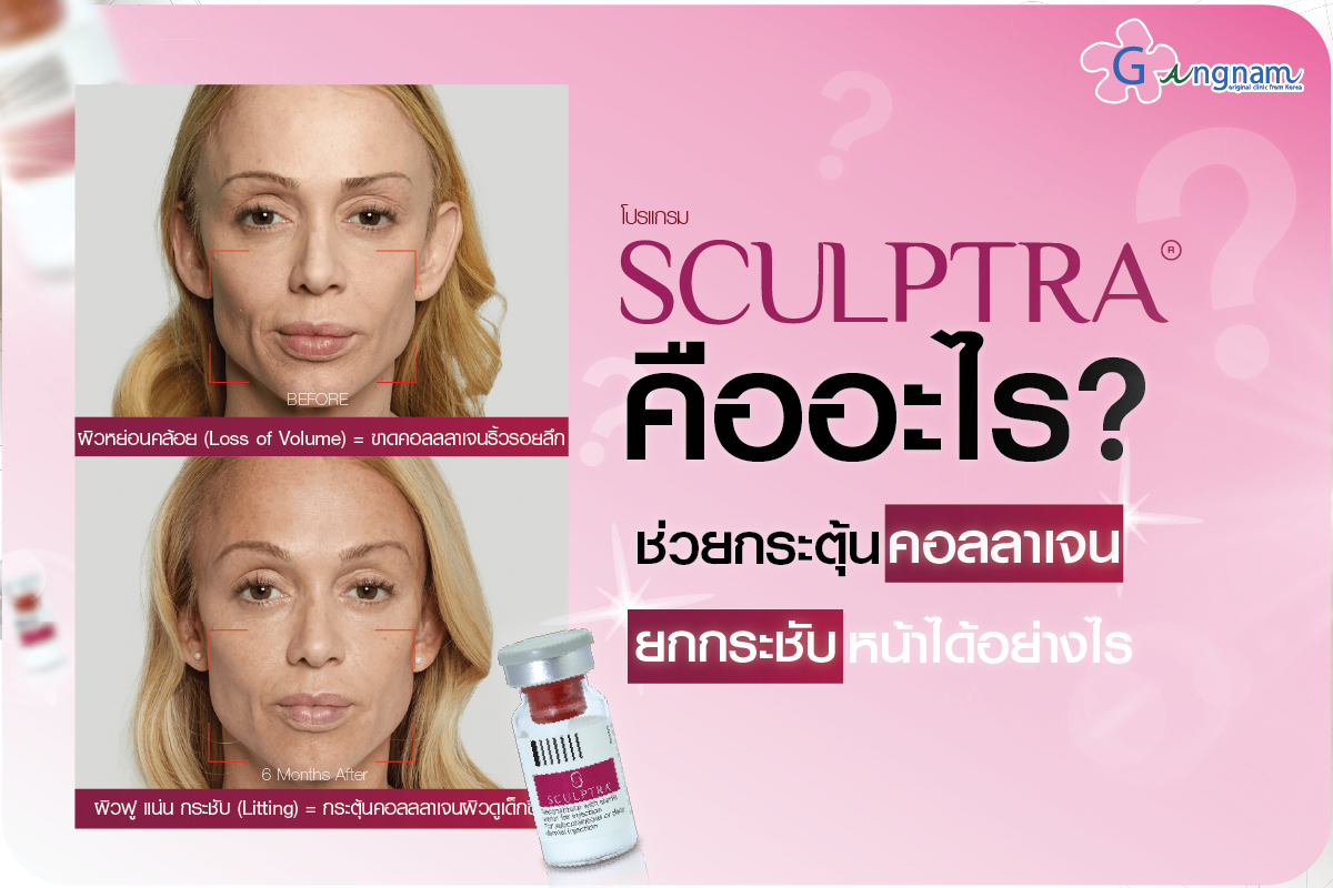 Sculptra คืออะไร? ช่วยกระตุ้นคอลลาเจนและยกกระชับหน้าได้อย่างไร